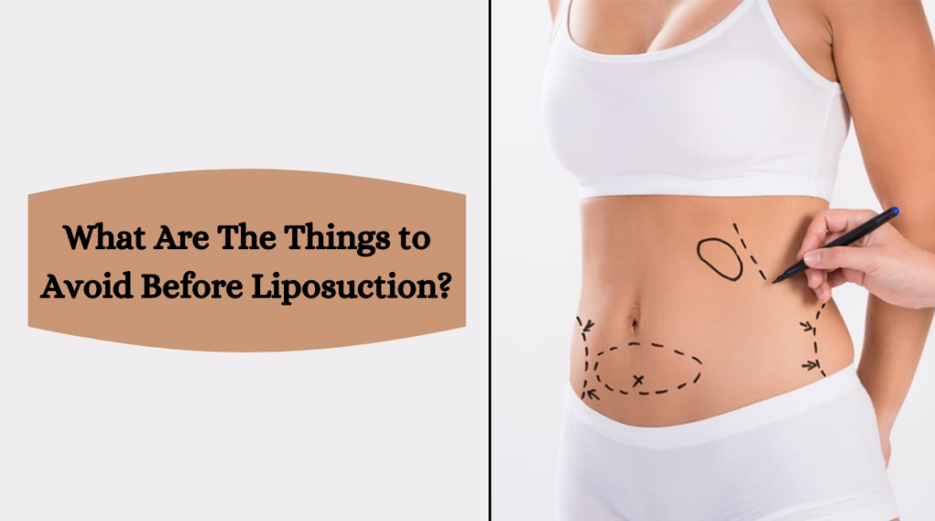 What Are The Things to Avoid Before Liposuction