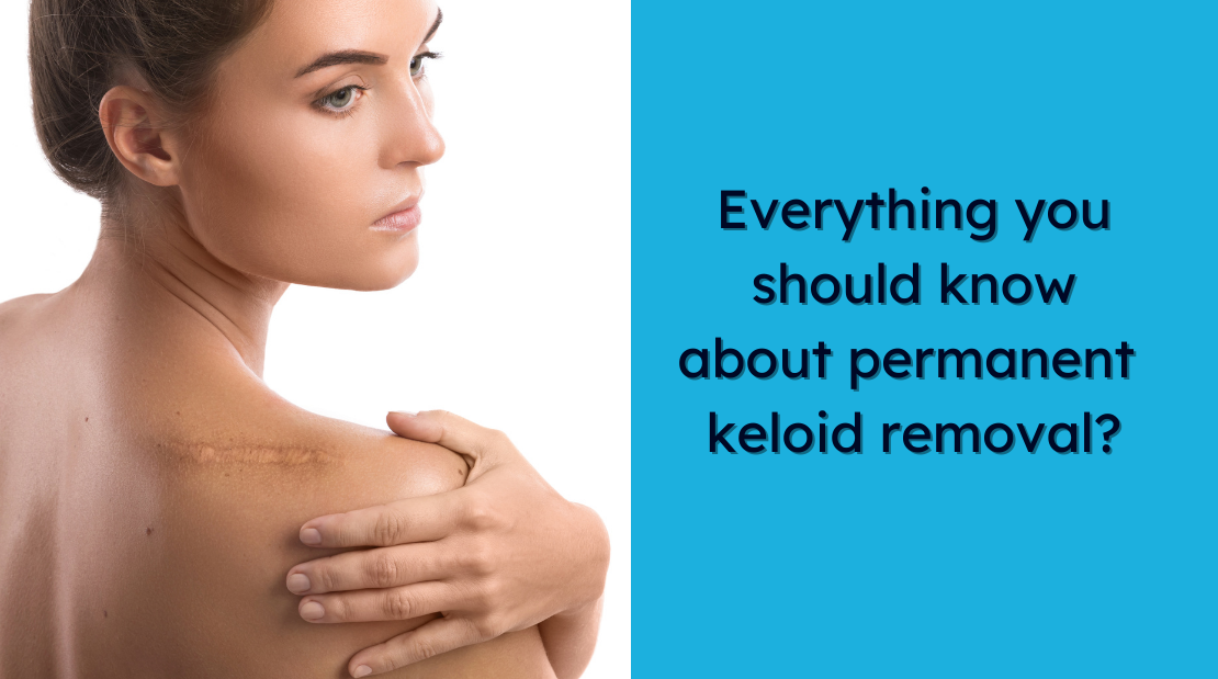 Permanent keloid removal