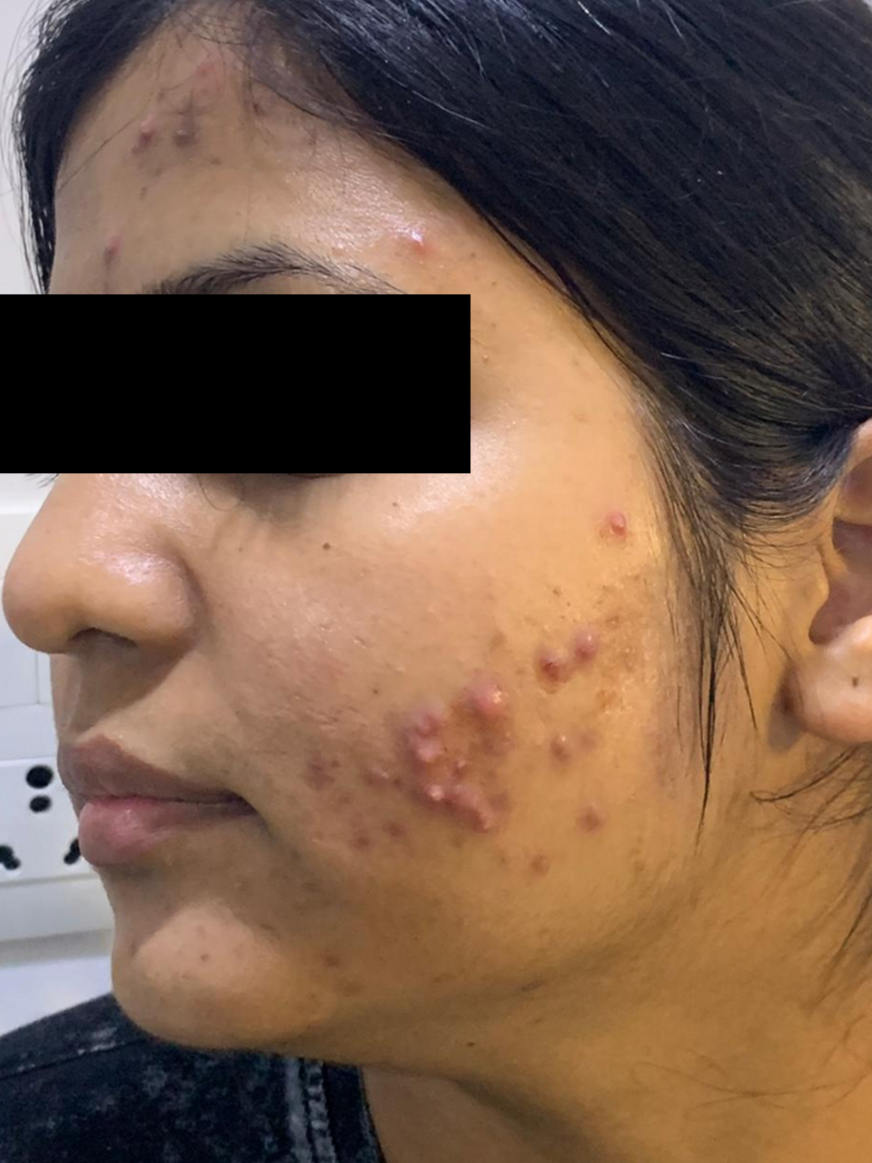 Before skin treatment image