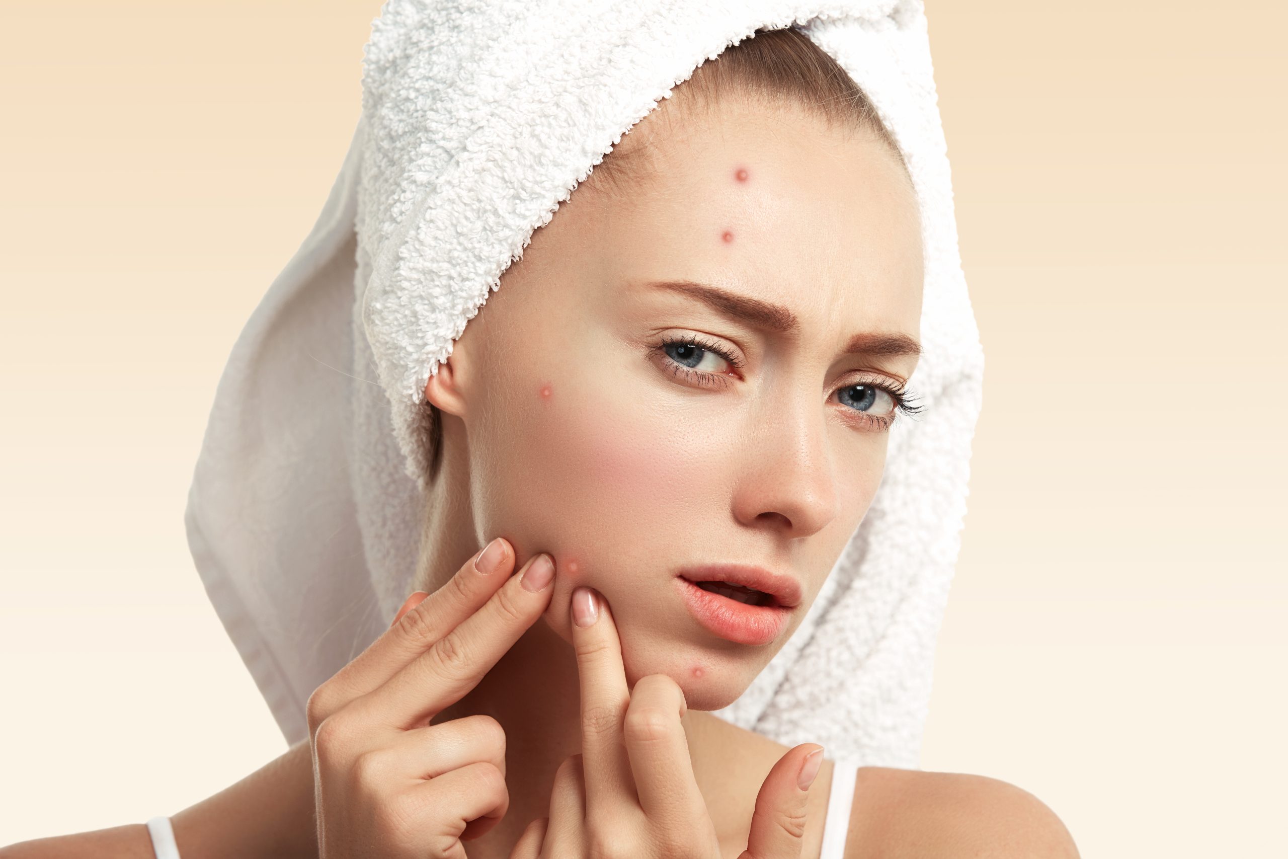 Skin & Hair Disorders
